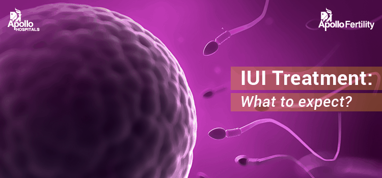 IUI Treatment: What to Expect?