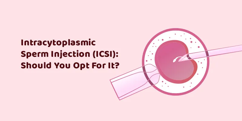 Intracytoplasmic Sperm Injection (ICSI): Should You Opt for It?