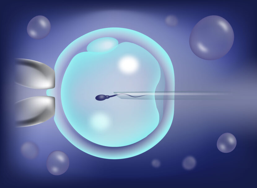 ICSI: How Is It Different from IVF