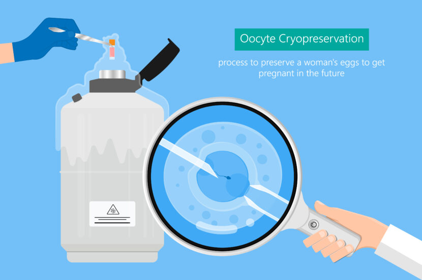 Oocyte Vitrification: A Quick Walk-Through