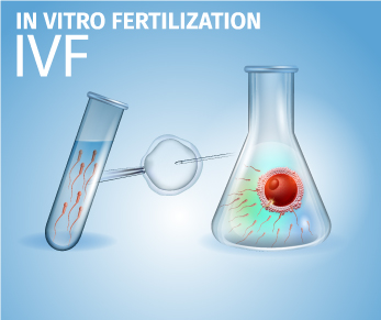 What Are the Various Tests Performed Before IVF?