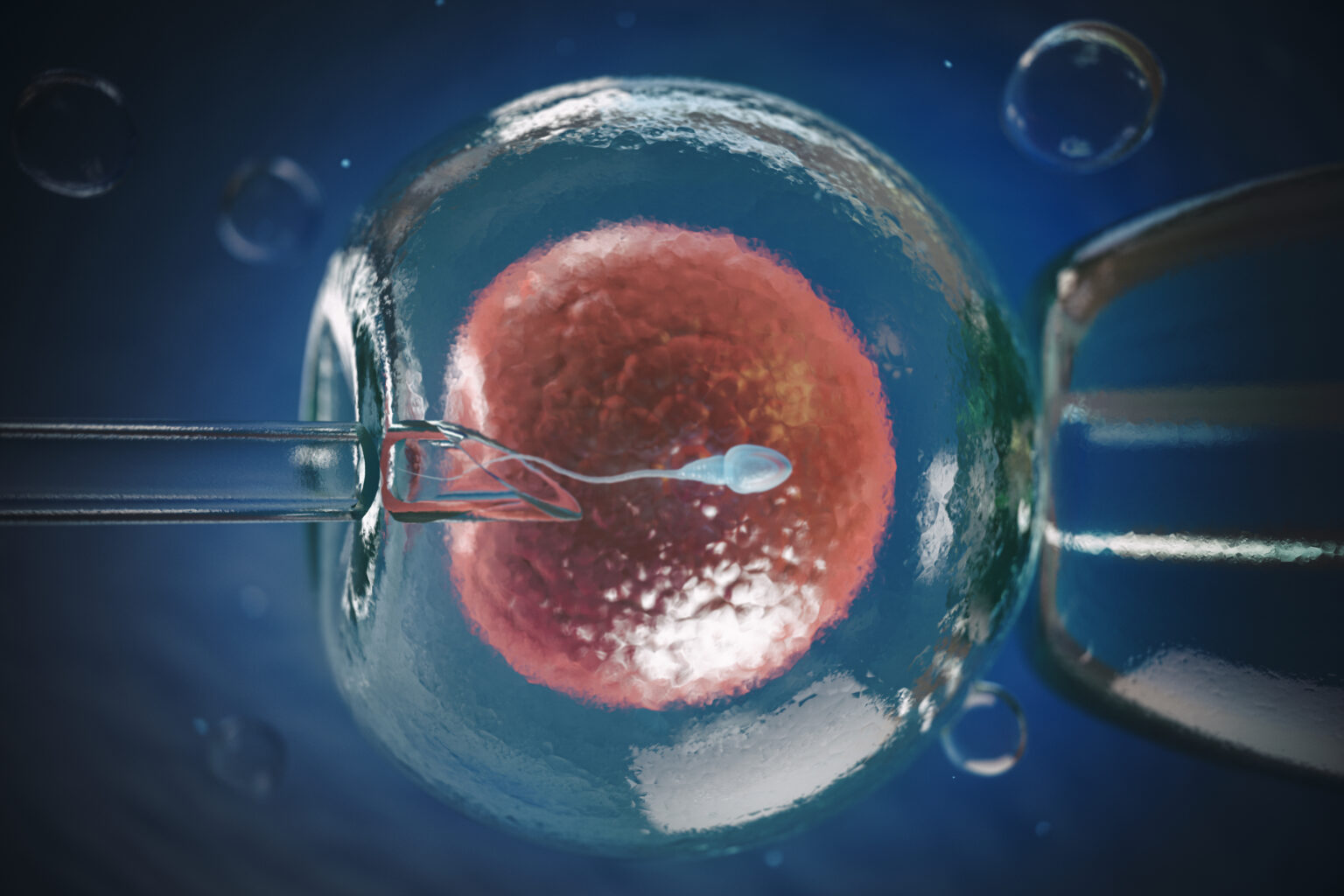 Why Does IVF Fail?