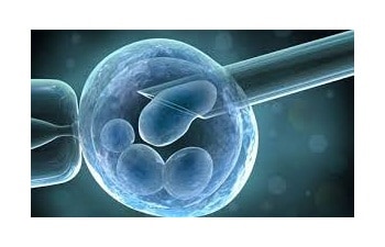 Surgical Sperm Retrieval Procedure