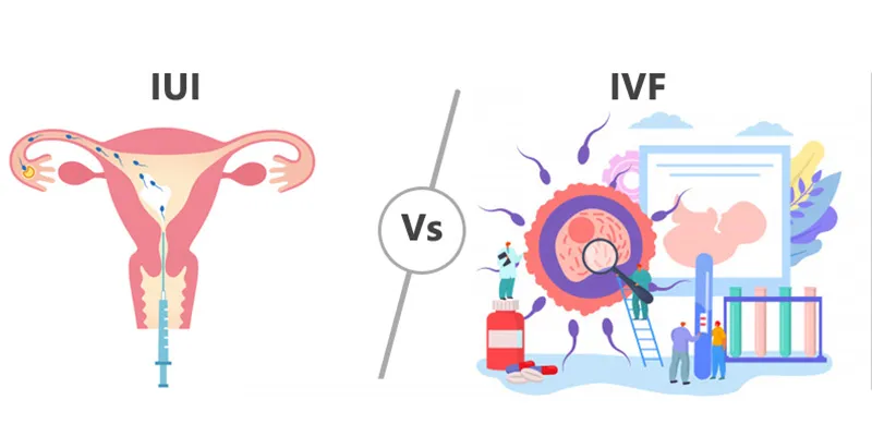 IUI vs. IVF: Which Fertility Treatment Option is Right for You