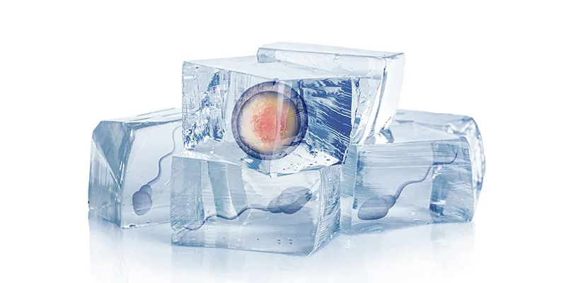 Fertility Preservation / Gamete Freezing - Need of the hour