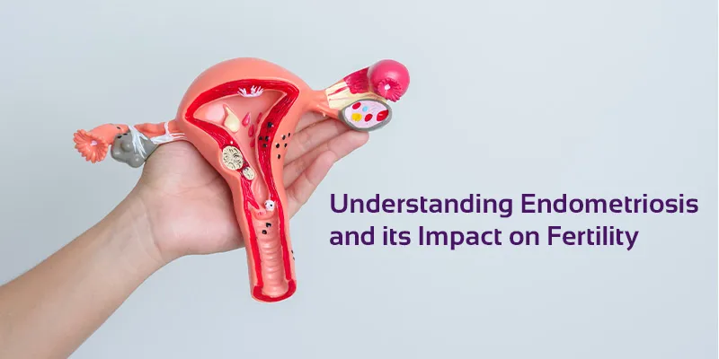 Infertility And Endometriosis