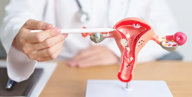 Tubal Factor Infertility