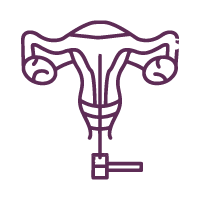 Hysteroscopy